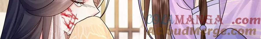 174 毁容72