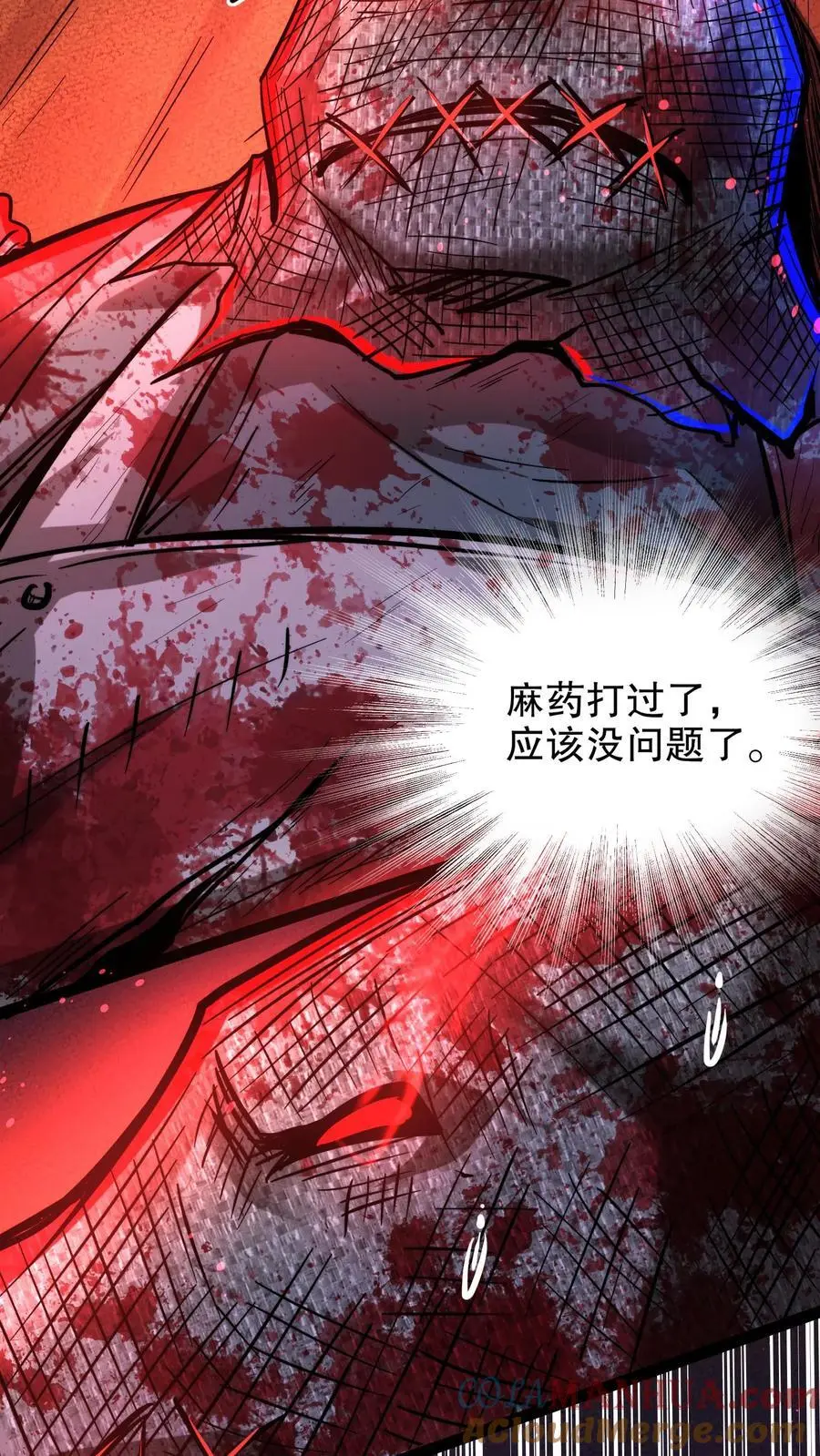 第196话 给师父做手术2