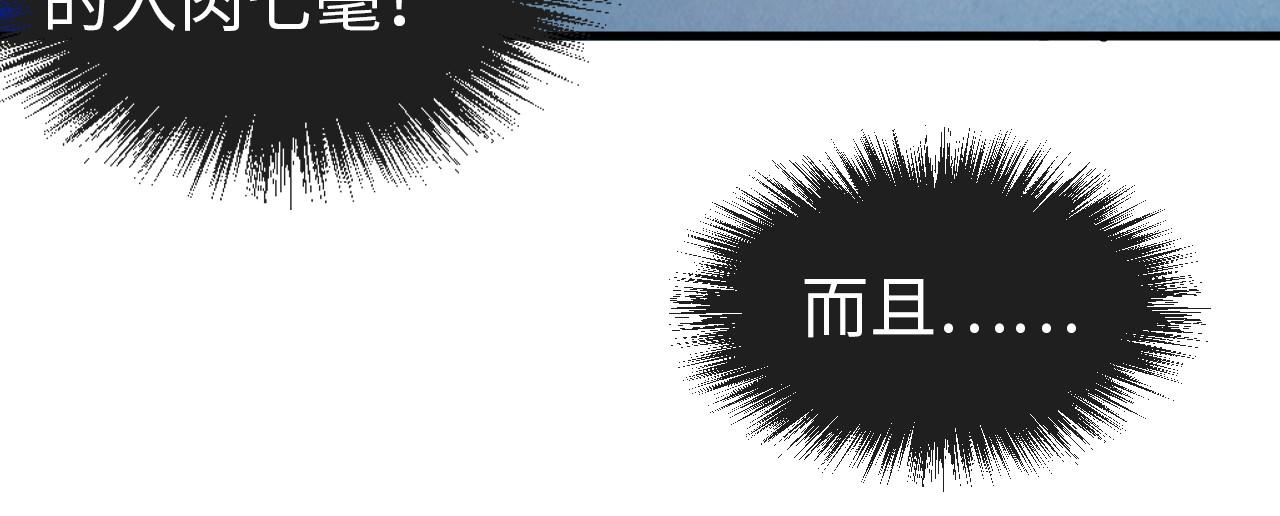 第34话 金针刺穴60