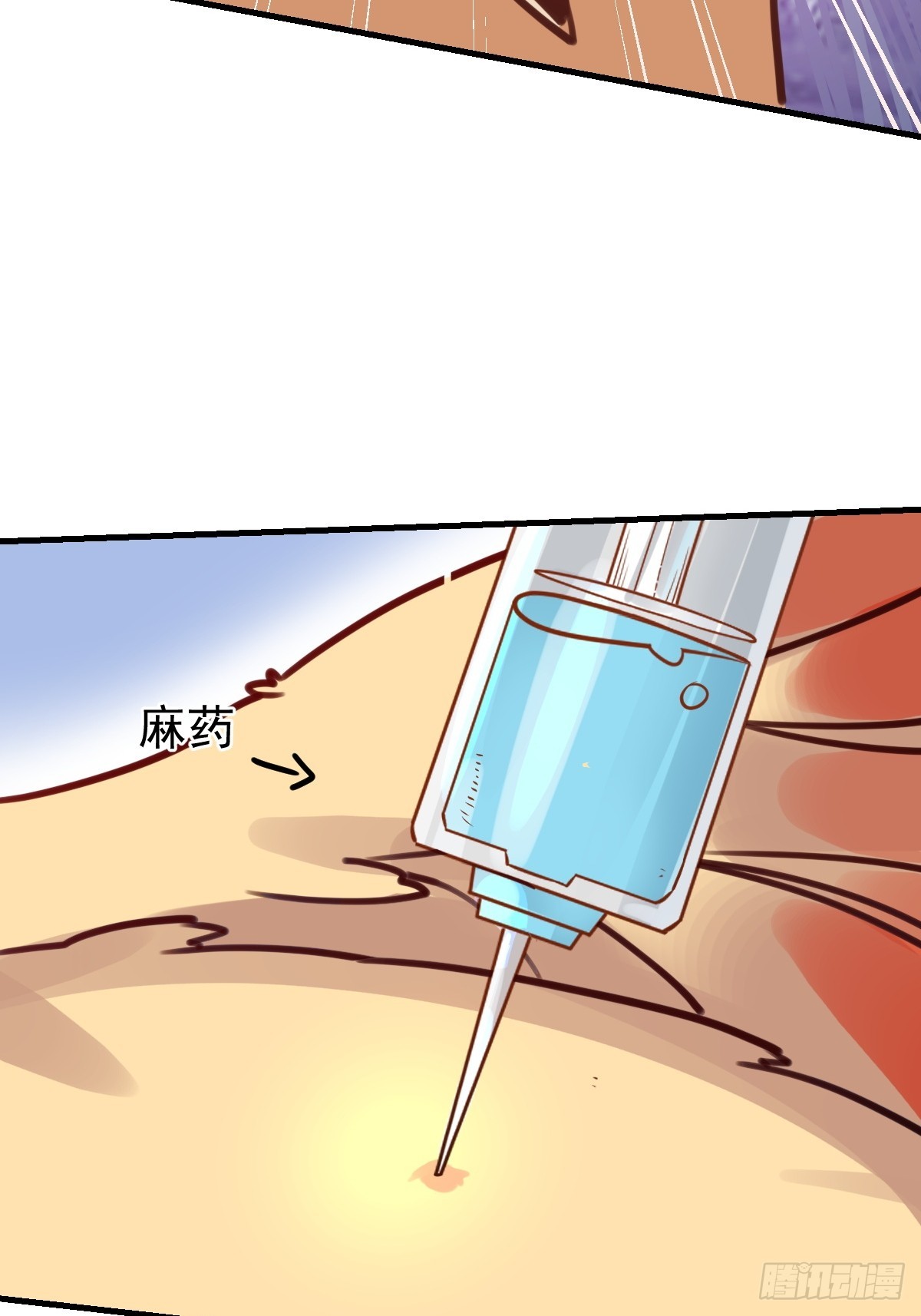 155话44