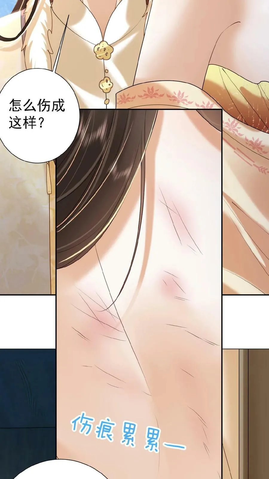 第142话 吹一吹就不痛了5