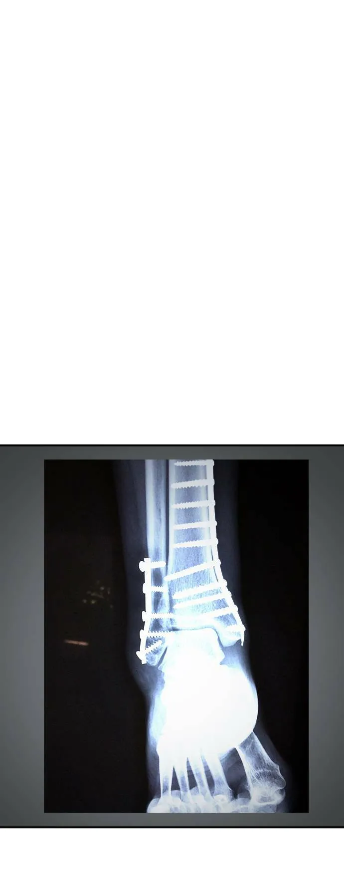 艾登 1145