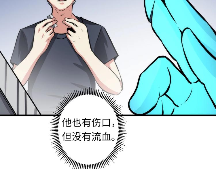 第33话 弗兰肯斯坦118