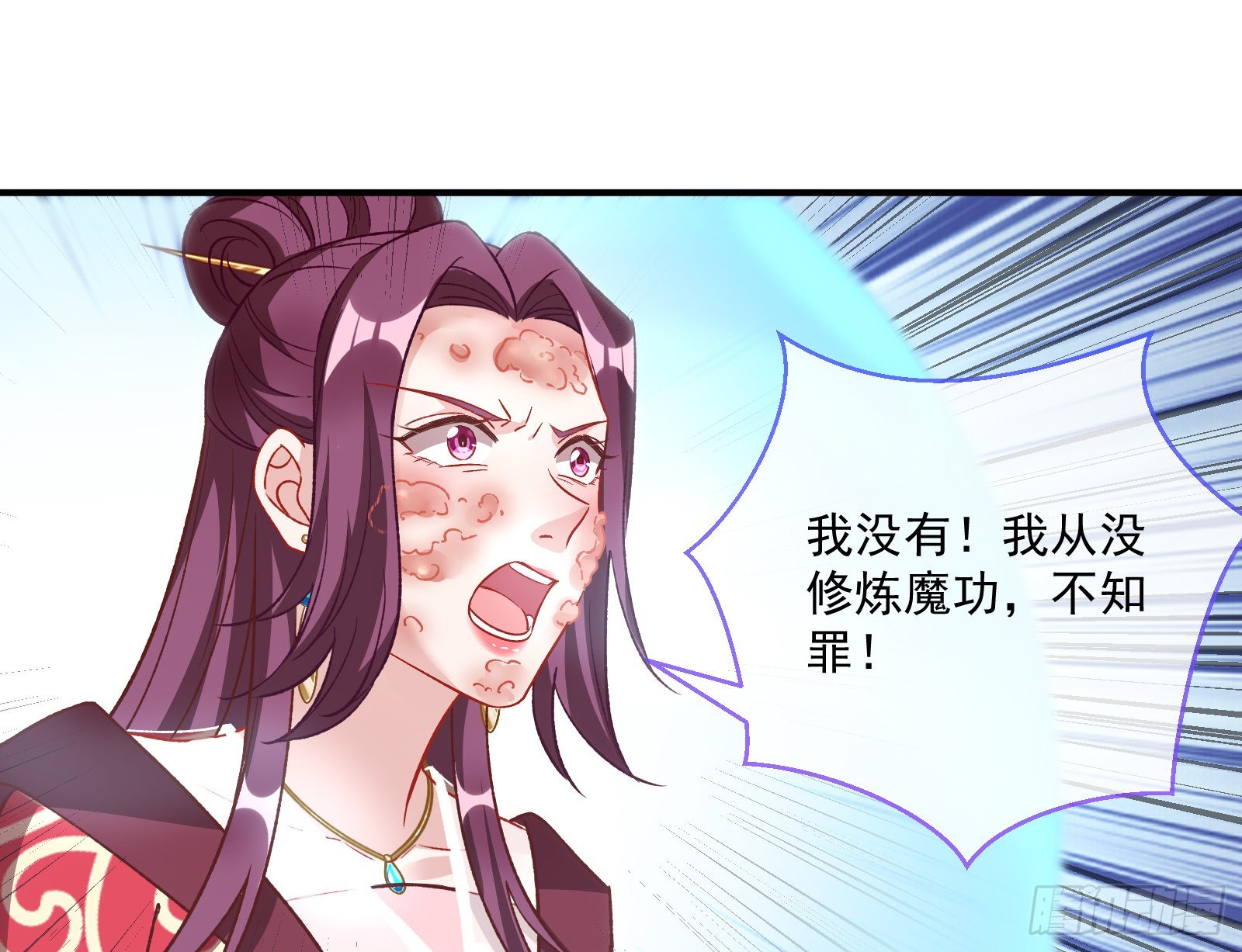 反噬57