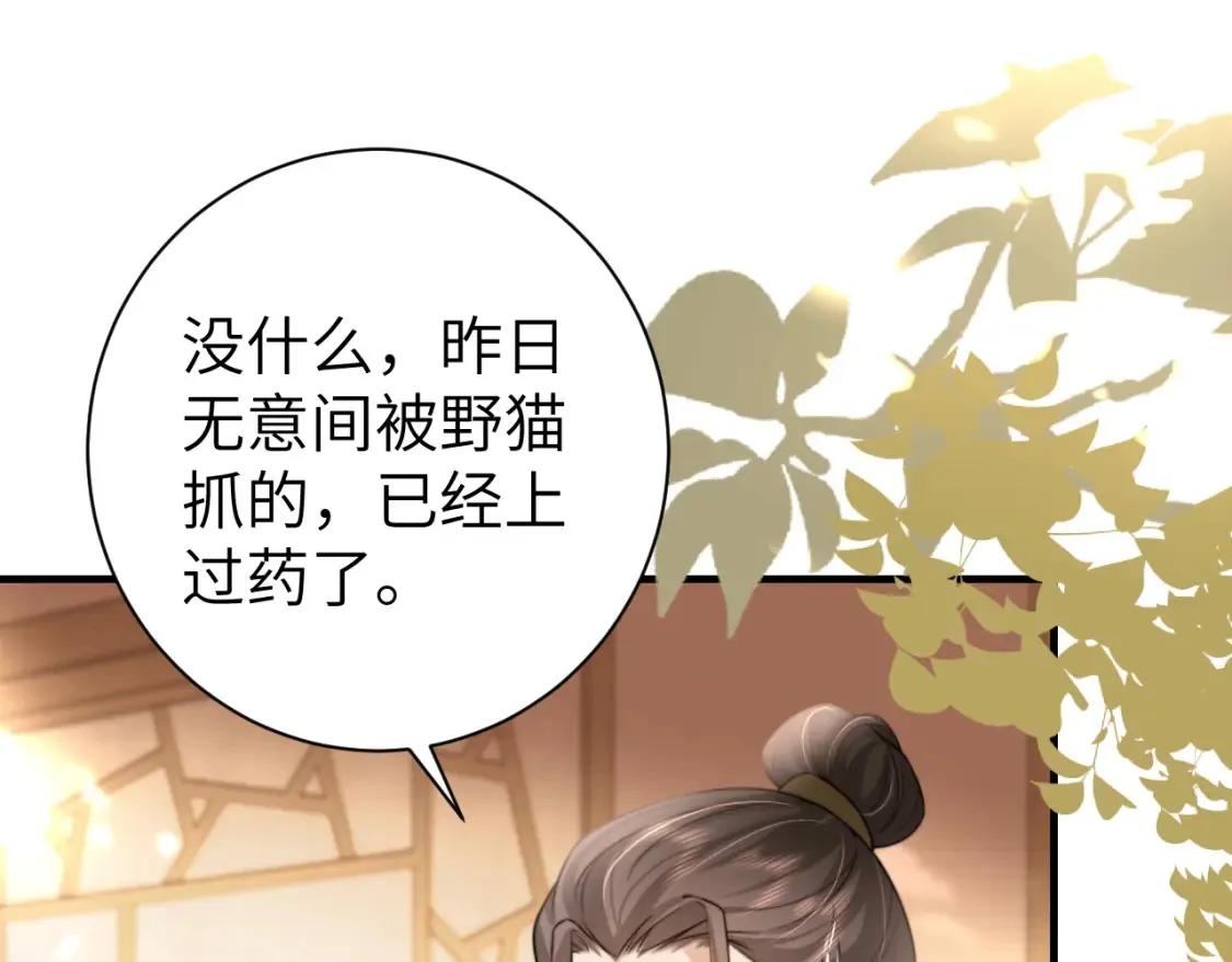 第235话 断指39