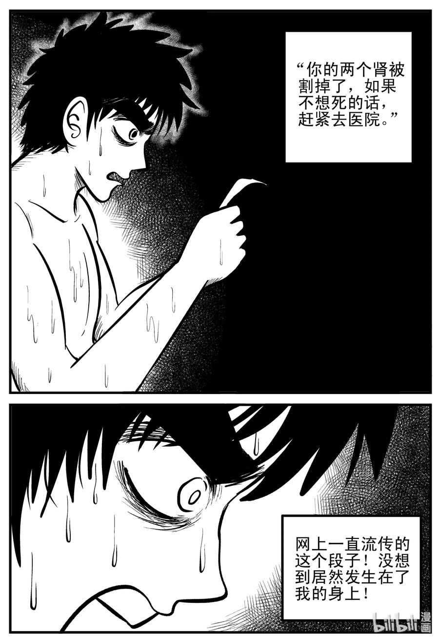 205 谁偷了我的肾（1）5