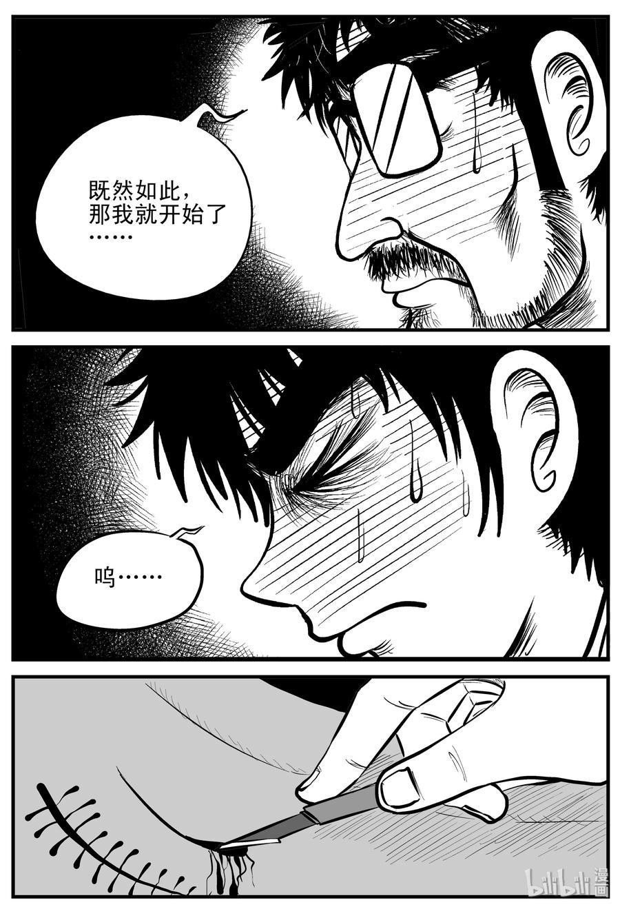 206 谁偷了我的肾（2）16