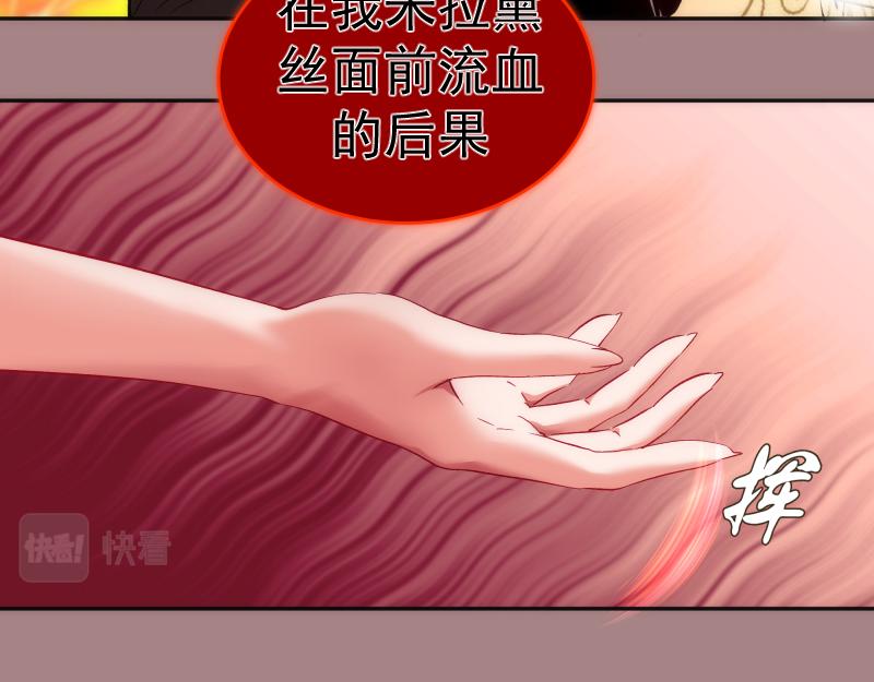第204话 基德vs米拉黛丝99