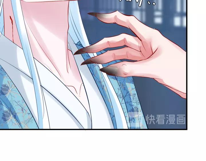 第36话 陷阱135