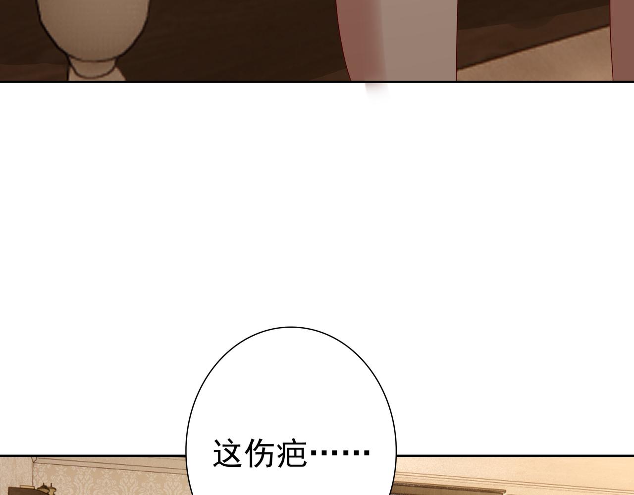 第60话 伤疤54