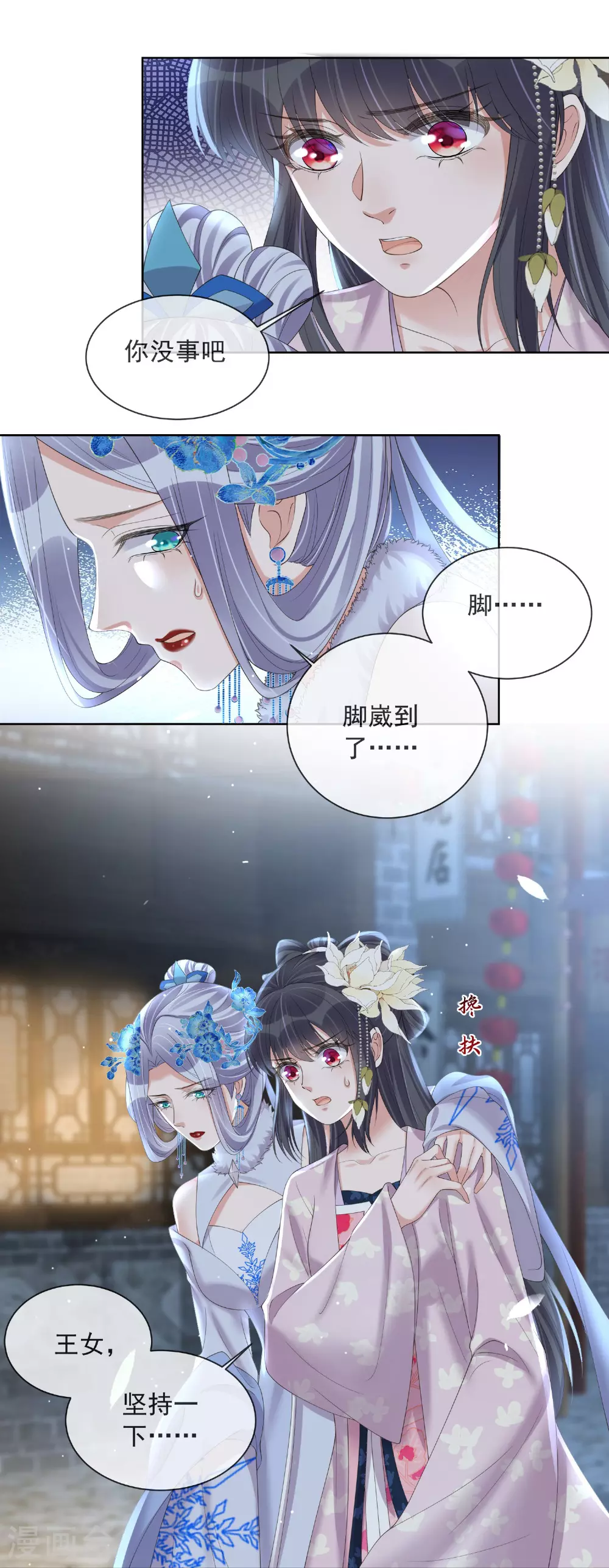 第160话 你居然装瘸32