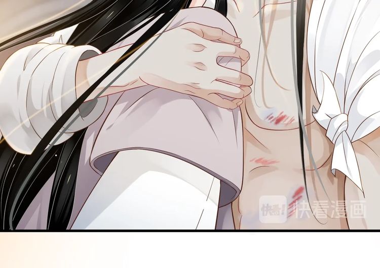 第75话 亲亲就不疼了76