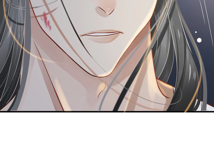 第75话 亲亲就不疼了58