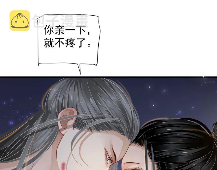 第75话 亲亲就不疼了39