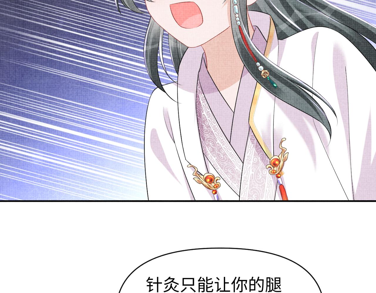 第150话 帮二皇子治腿79