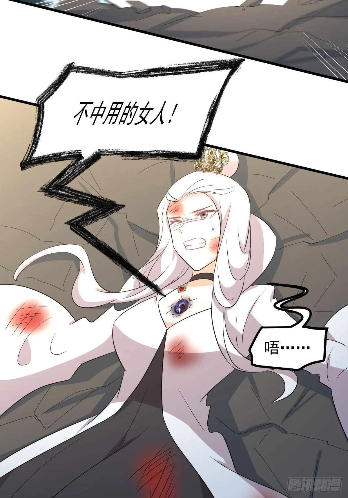 第379话 人石大战41