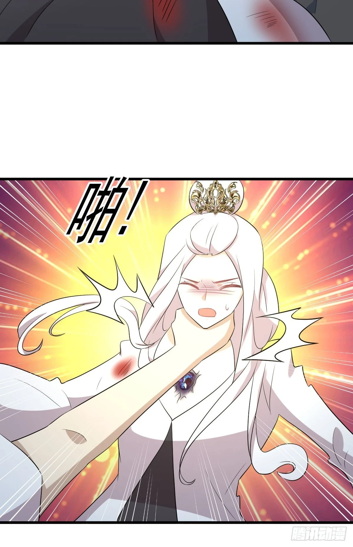 第379话 人石大战42