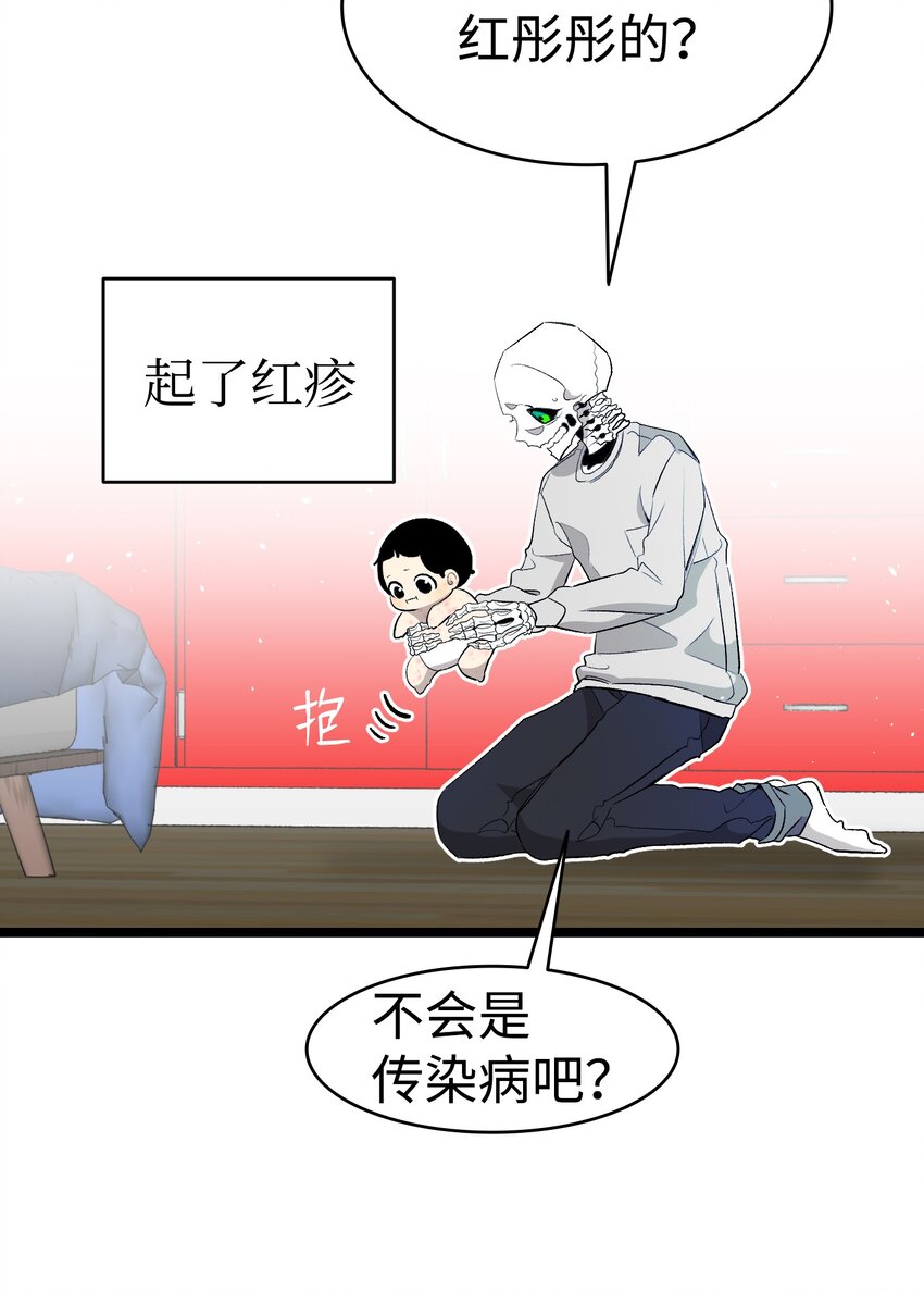 150 骨头断裂37