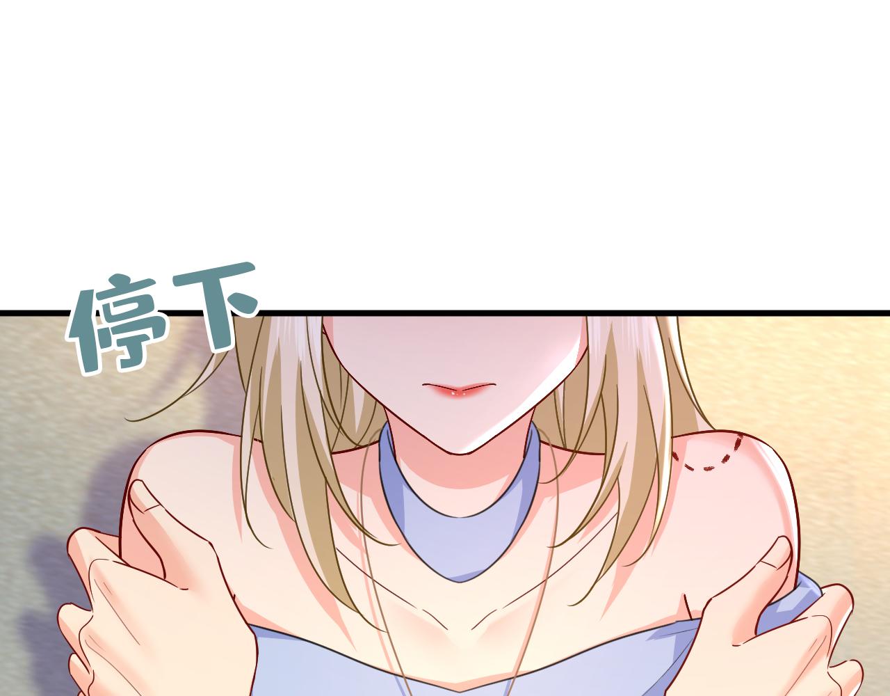 第542话 你的手怎么回事？61