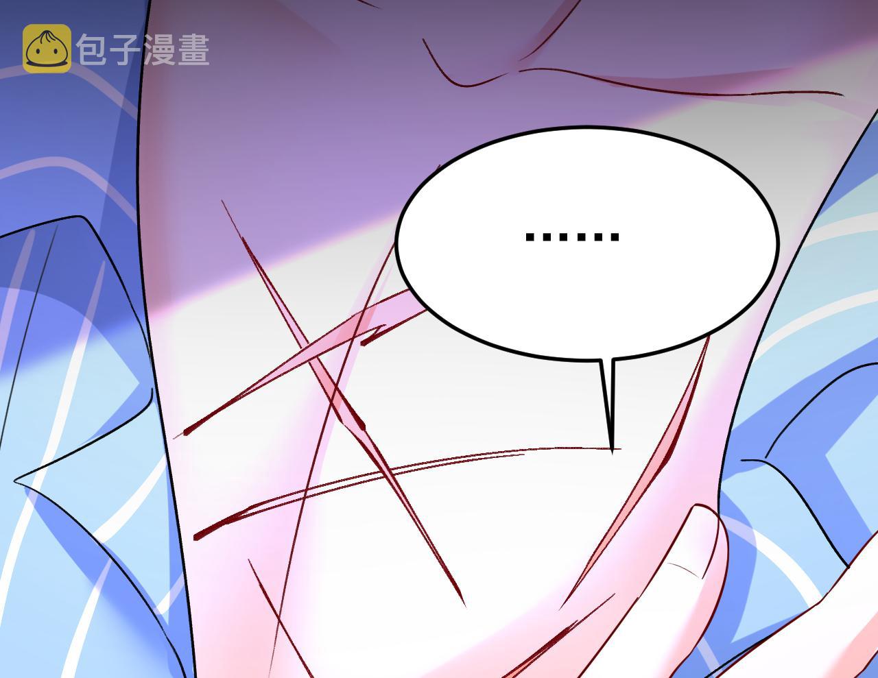 第533话 你的伤，还疼吗76