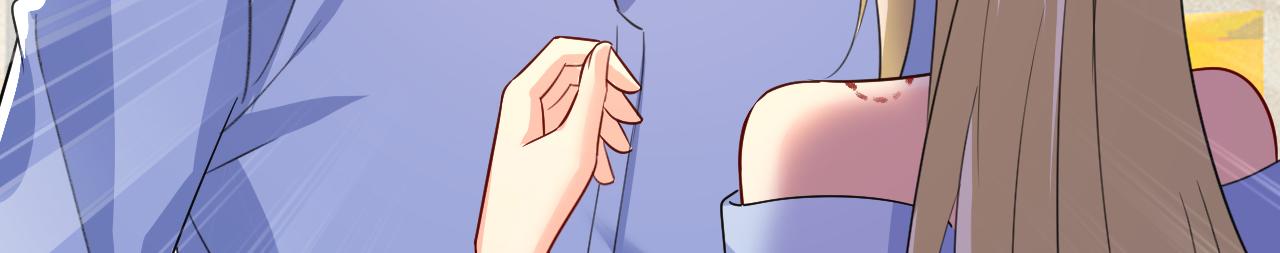 第542话 你的手怎么回事？77