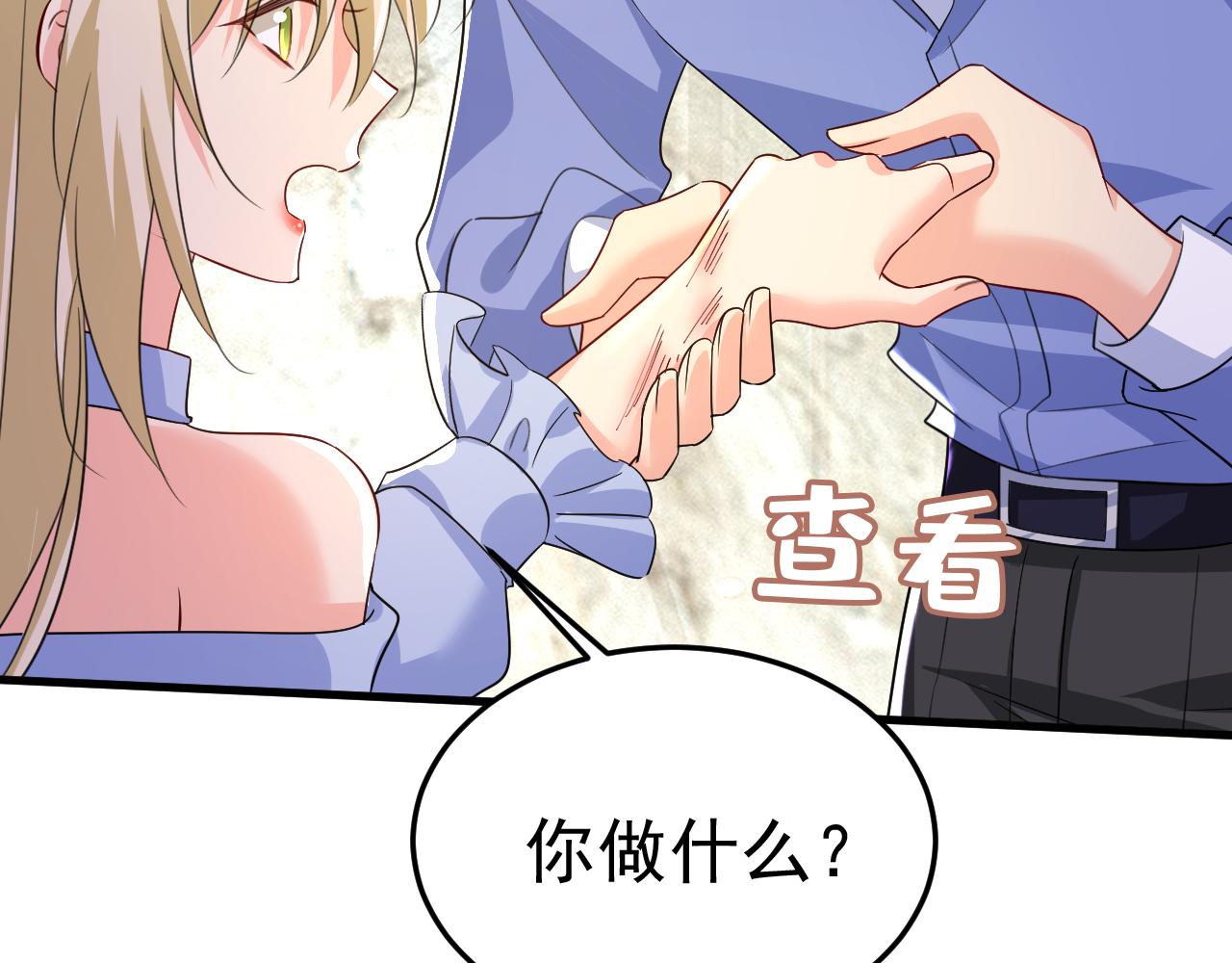 第542话 你的手怎么回事？86