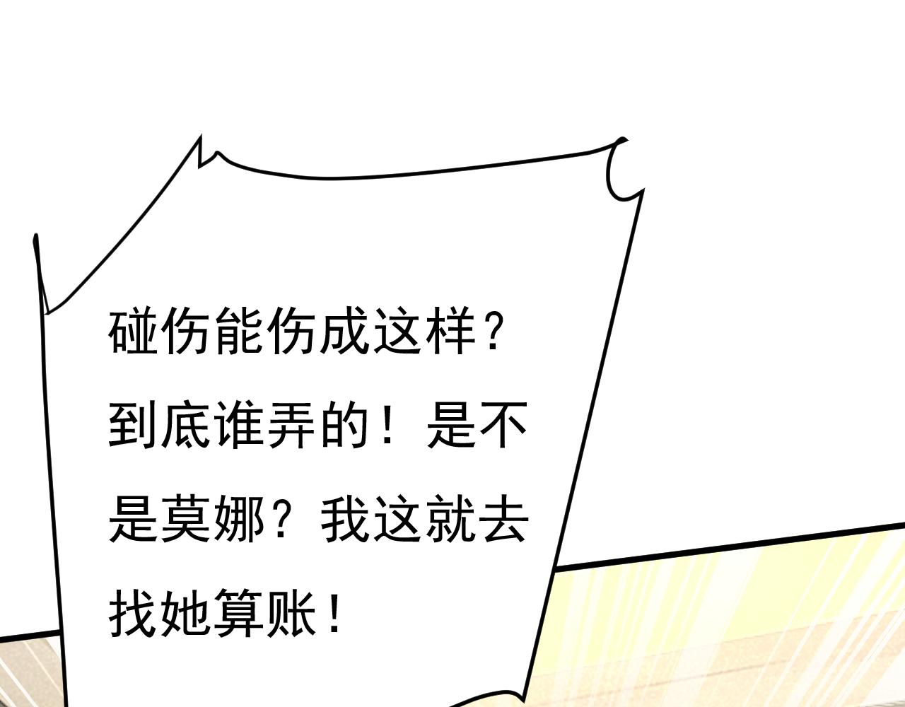 第542话 你的手怎么回事？75