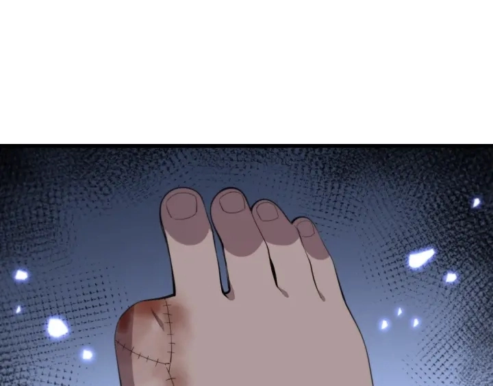 第64话 拇指缺损再造87