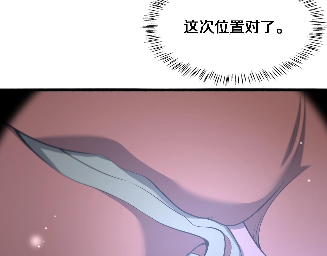 第165话 胆囊手术70