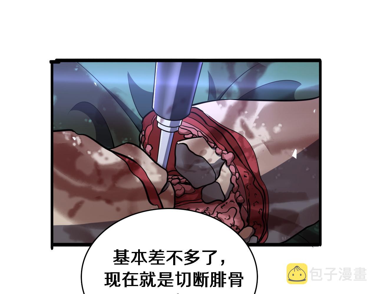 第95话 第一次做截肢手术84