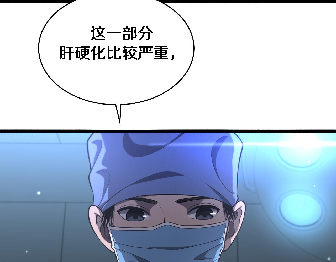 第158话 肝癌手术开始90