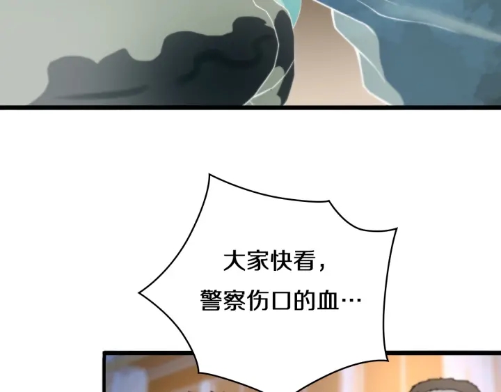 第43话 徒手止血2.0（上）101