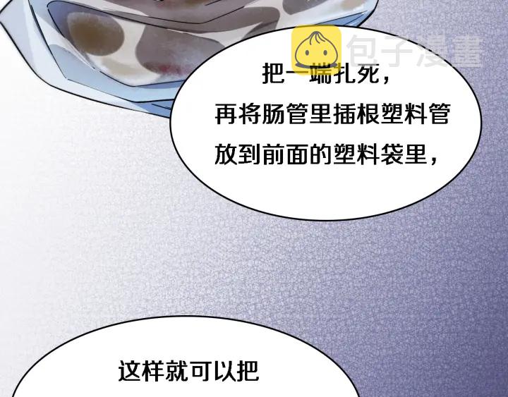 第66话 有味道的肠梗阻手术66