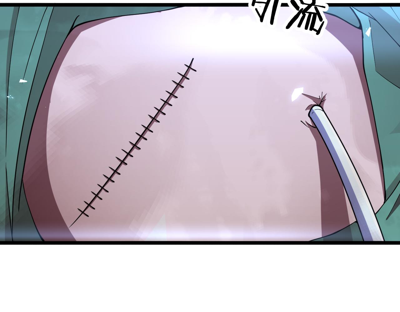 第140话 抢救66
