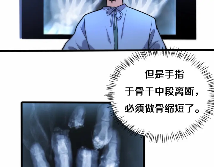 第58话 断指再植73