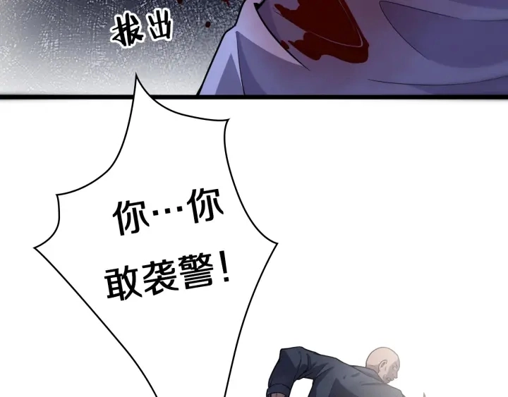 第43话 徒手止血2.0（上）52