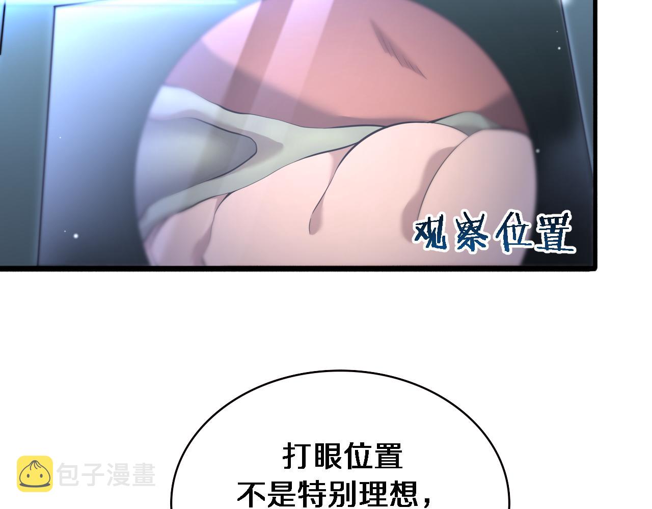第165话 胆囊手术65