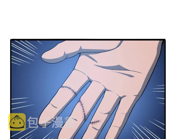 第31话 手术费92