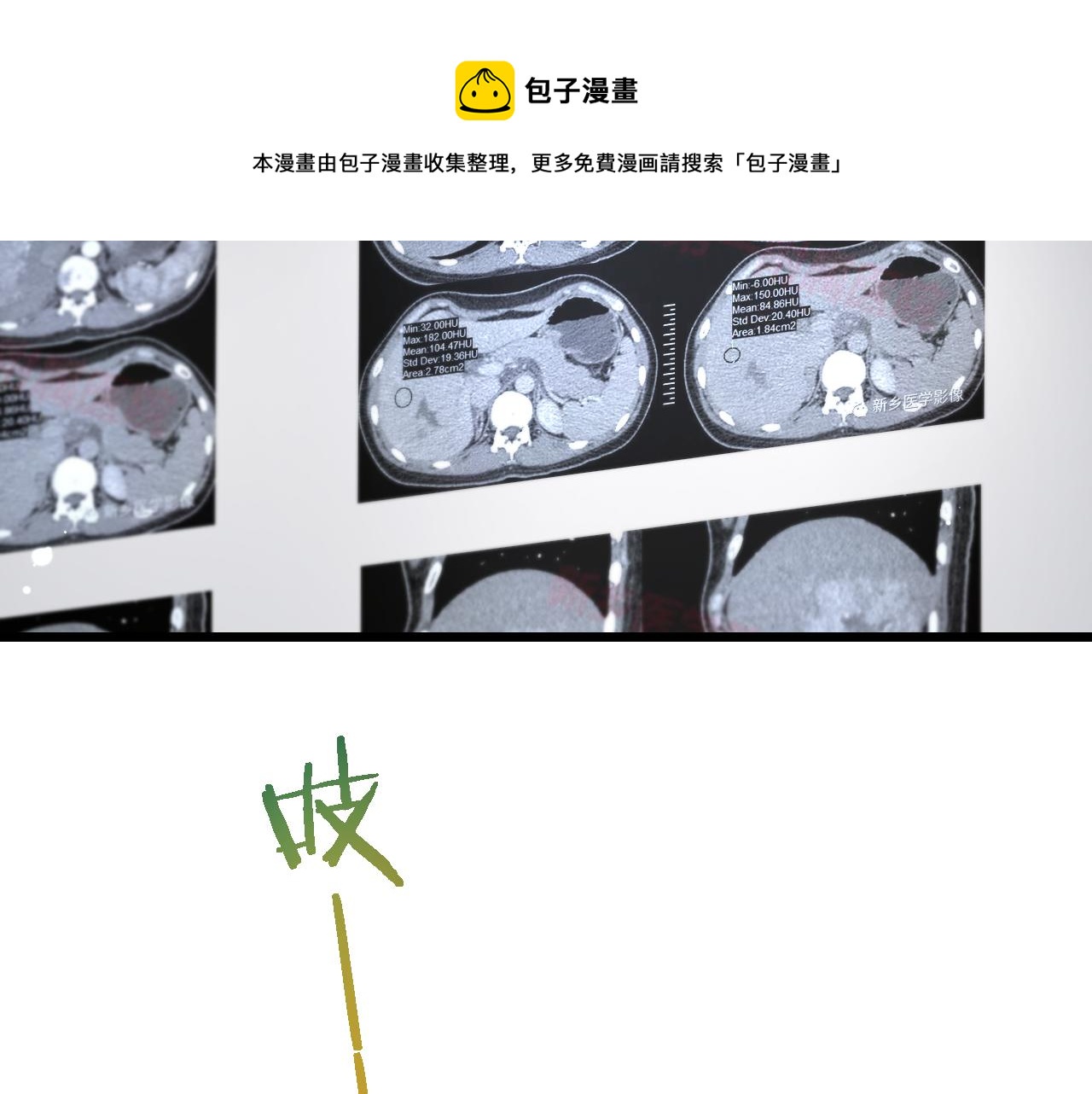 第177话 规则，用强大碾平49