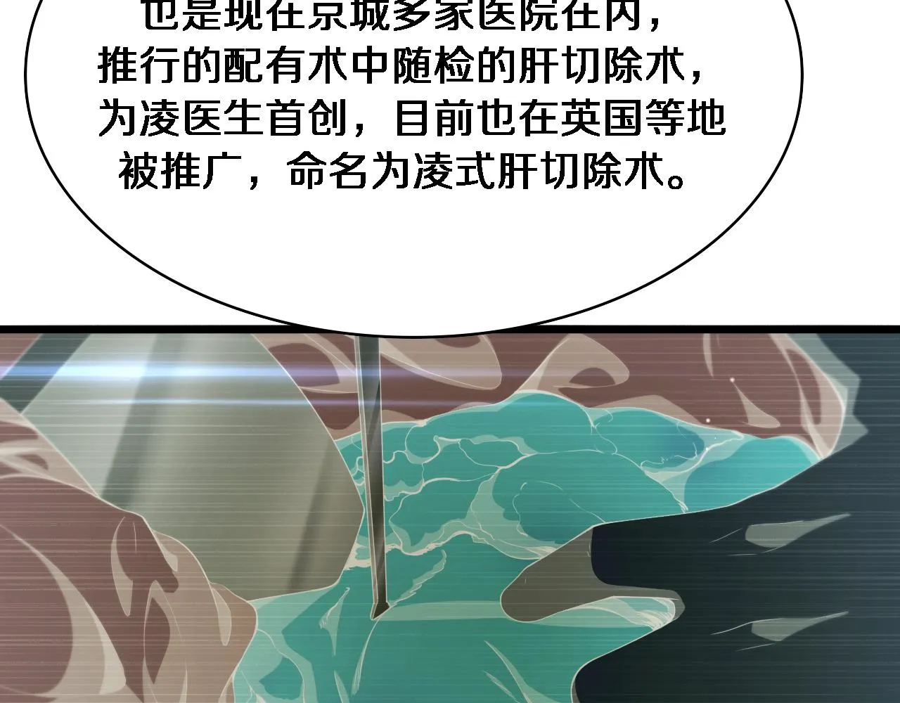 第233话 胃癌手术，接了！82