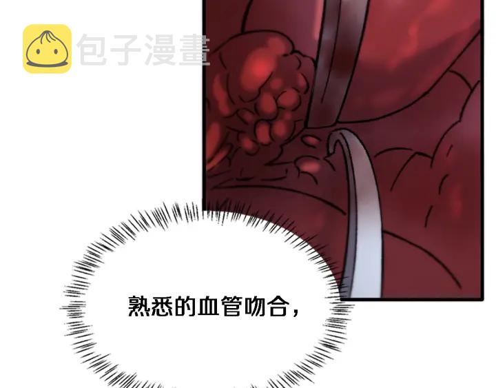 第58话 断指再植35