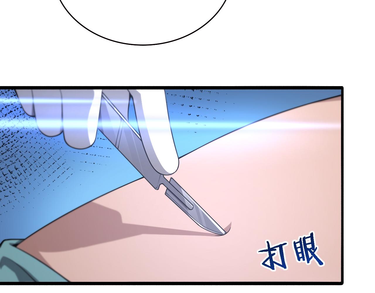 第165话 胆囊手术63