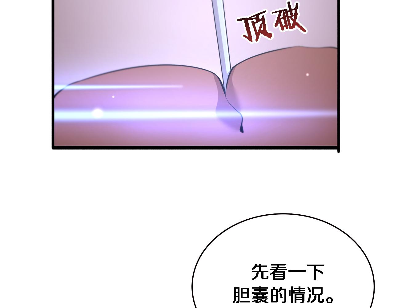 第165话 胆囊手术74
