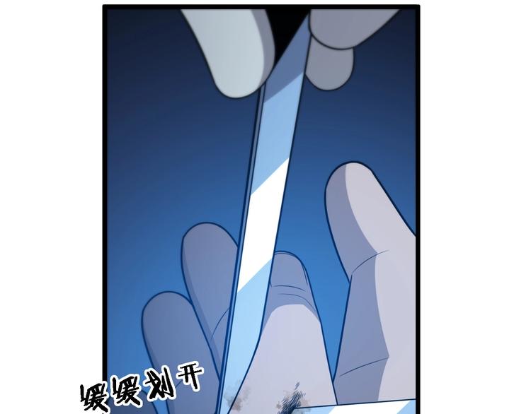 第26话 开刀50