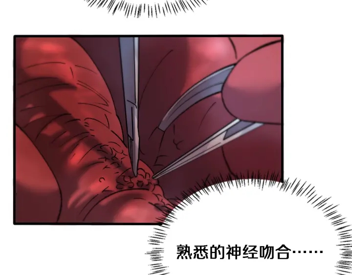 第58话 断指再植36
