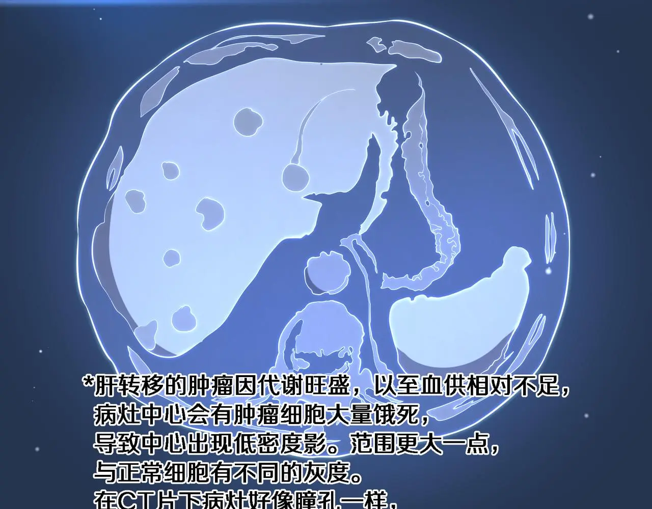 第257话 肝胃联合根治术35