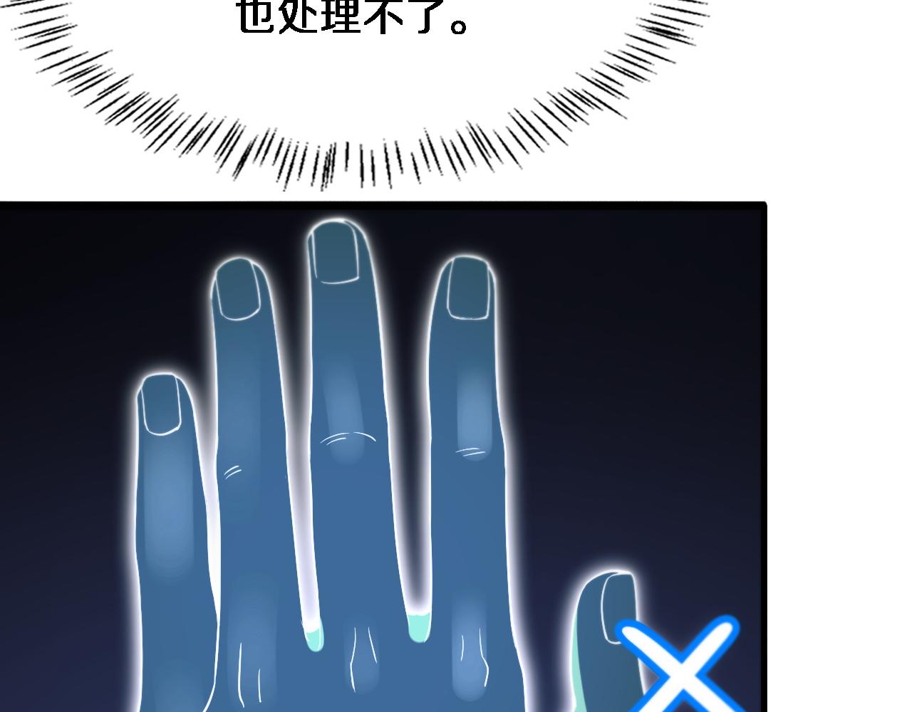 第73话 完美级断指再植65