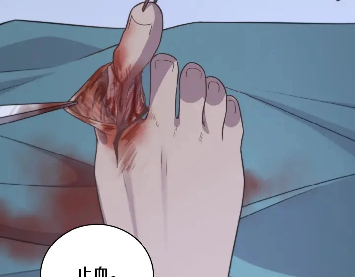 第64话 拇指缺损再造65