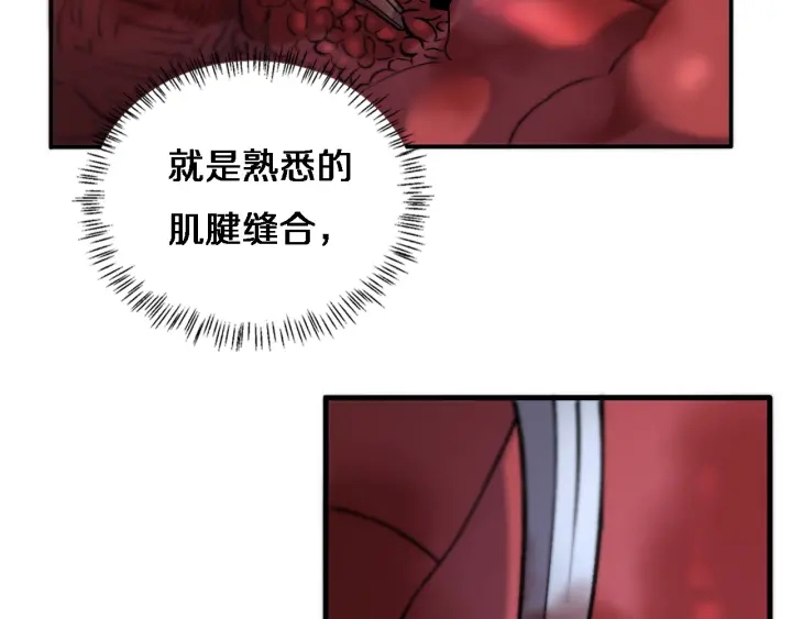第58话 断指再植34