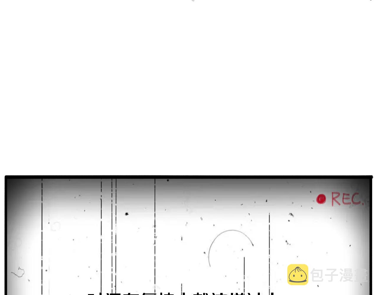 第158话 肝癌手术开始104